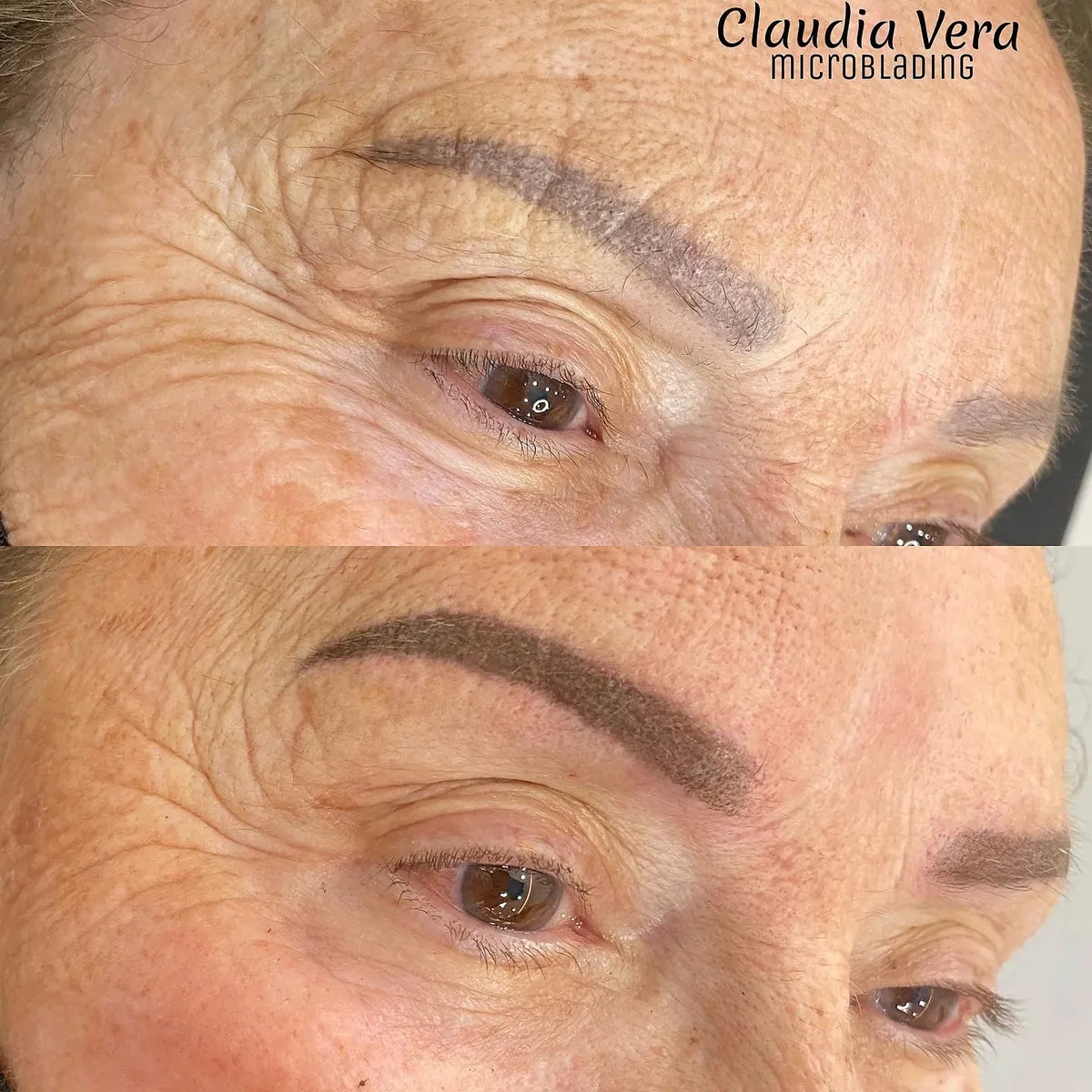 Arriba, una micropigmentación de cejas antigua virada a gris; abajo, la misma ceja tras la corrección, en tono castaño